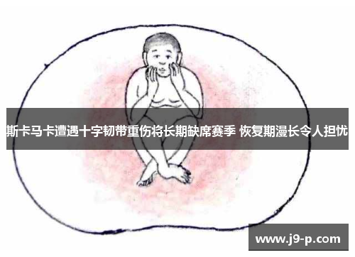 斯卡马卡遭遇十字韧带重伤将长期缺席赛季 恢复期漫长令人担忧